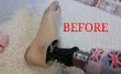 Hoe te zetten van een nieuwe voet op uw prothese. 