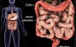 IBD: The Cure For Crohns en colitis ulcerosa