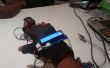 E-gezondheidszorg handschoen (Intel IoT)