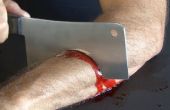 Bloed Spurting mes wond