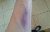 Hoe maak je thuis een nep Halloween Bruise.! 