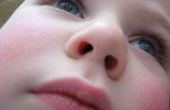 Verwijdering van object geplakt in kind neus vacuüm